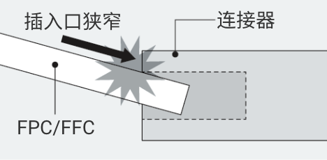插入口狭窄